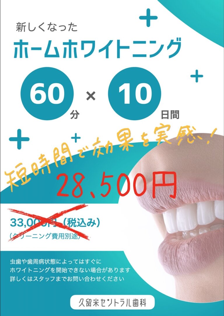 ホームホワイトニングキャンペーン