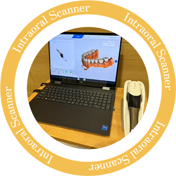 Intraoral scanner